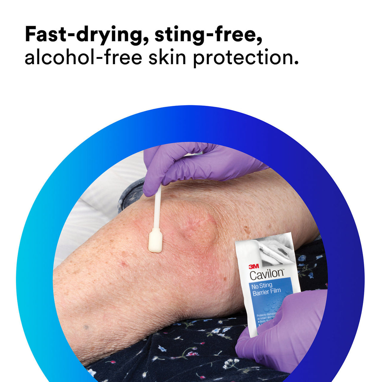 A person in purple gloves applies 3M Cavilon No Sting Barrier Film by 3M to someone’s leg using an applicator. Text: Fast-drying, sting-free barrier film for gentle, alcohol-free skin protection.