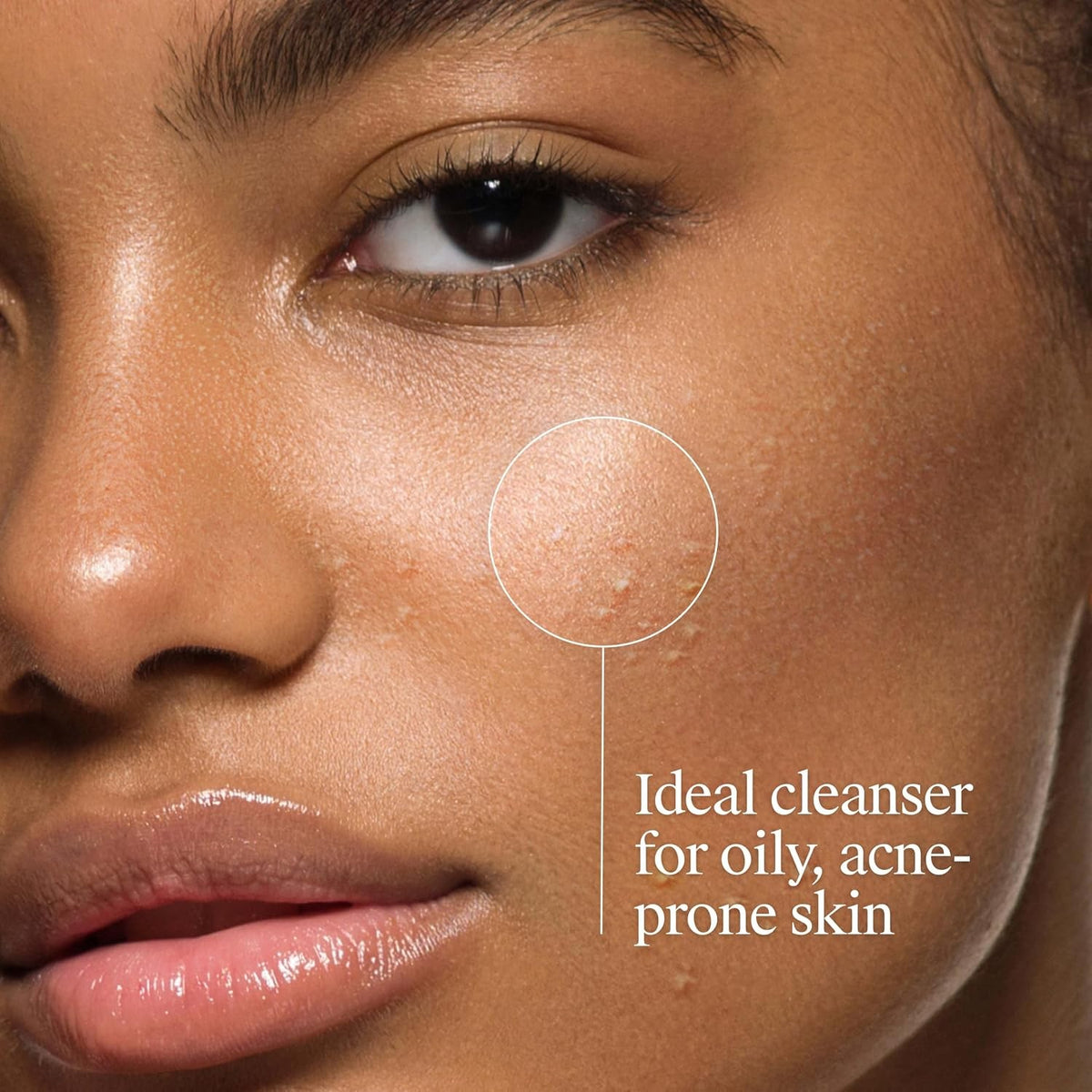 Neutrogena Oil-Free Acne Wash Liquid, 9.1 fl oz