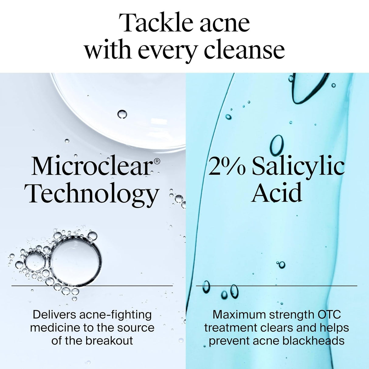 Neutrogena Oil-Free Acne Wash Liquid, 9.1 fl oz