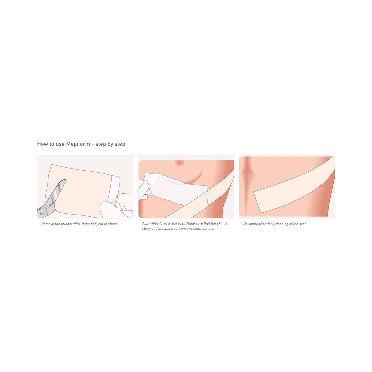 Mepilex Mepiform Silicone Sheeting, Rectangle Non-Sterile — 2" x 3"