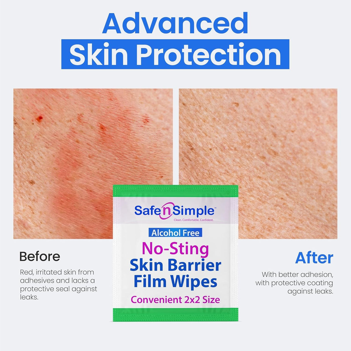 Safe n Simple No-Sting Skin Barrier Film, Unscented