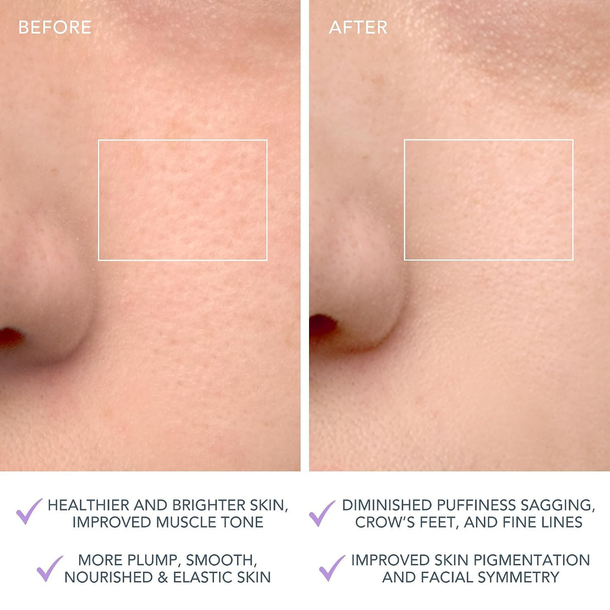 LUNA 4 Facial Cleansing Device for Sensitive Skin