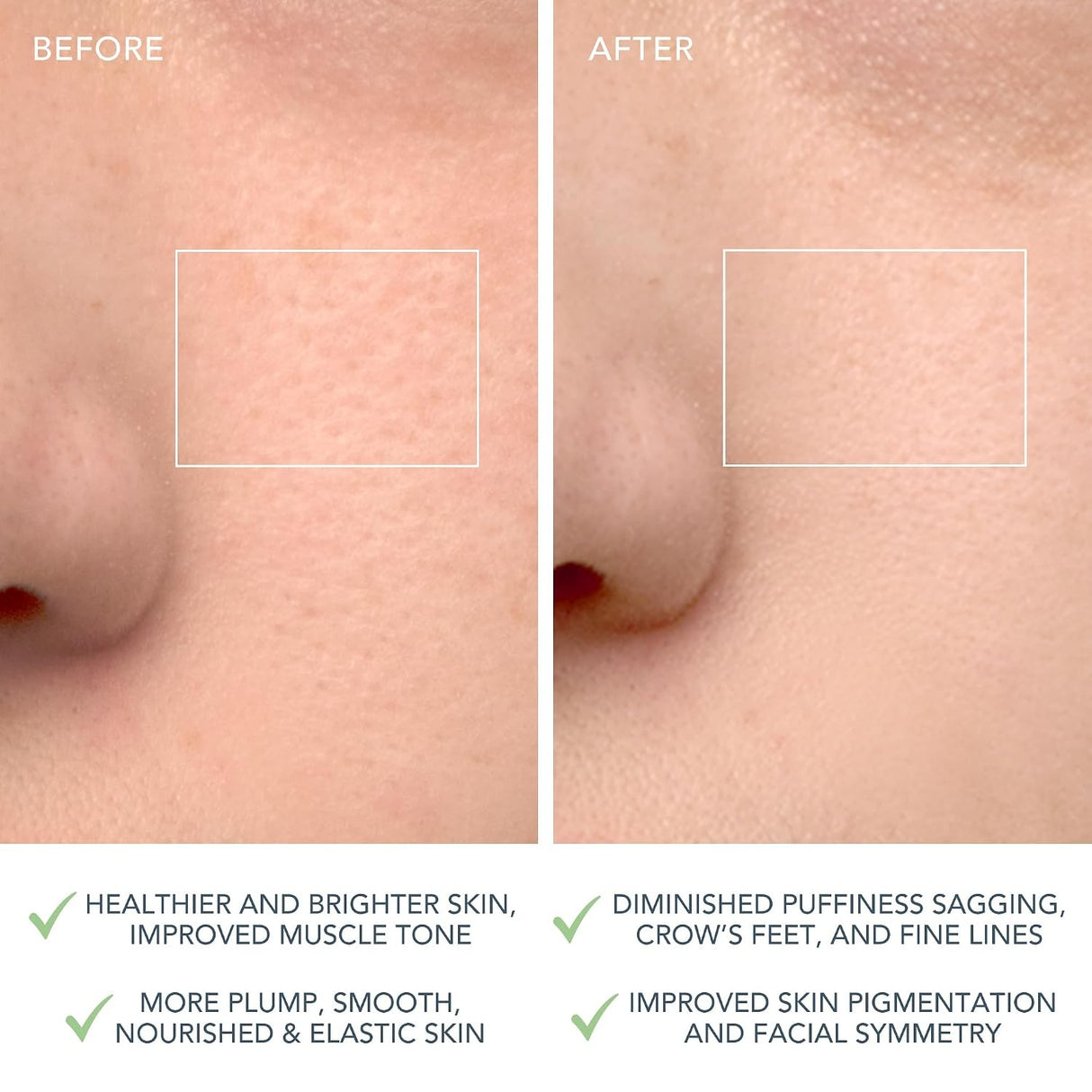 LUNA 4 Facial Cleansing Device for Combination Skin