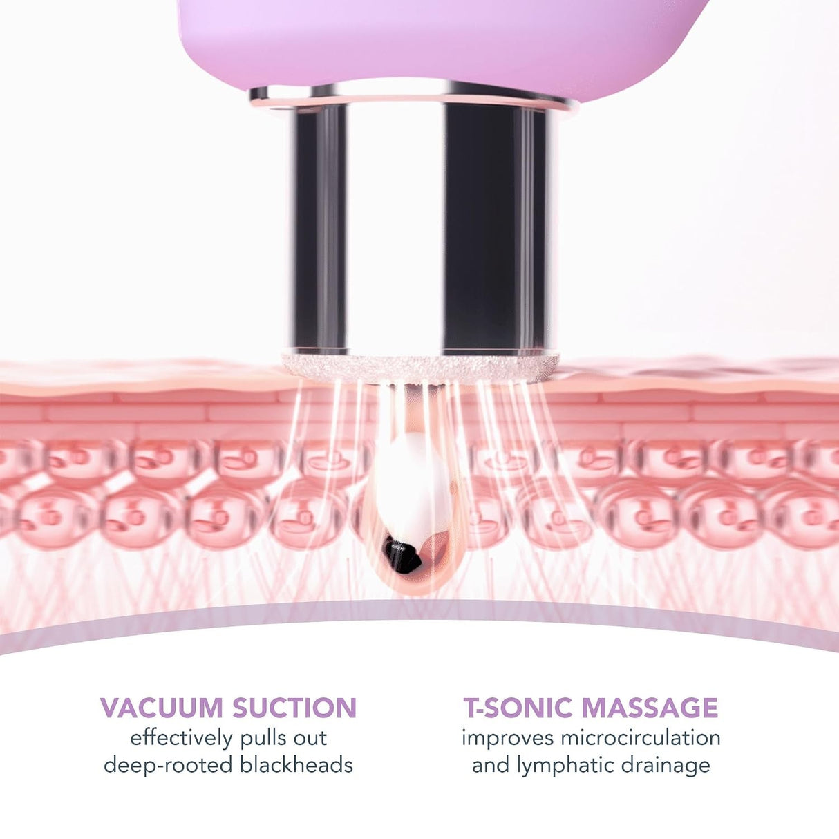 KIWI derma Microdermabrasion Pore Vacuum