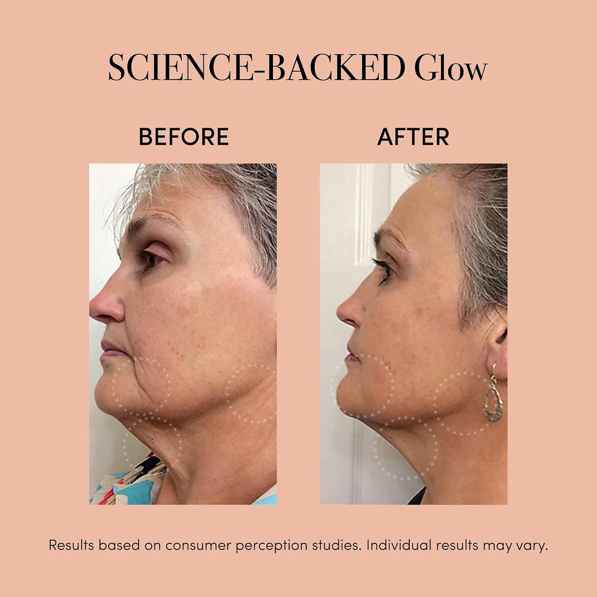 reVive Light Therapy Lux Collection Clinical Device, Anti-Aging and Acne