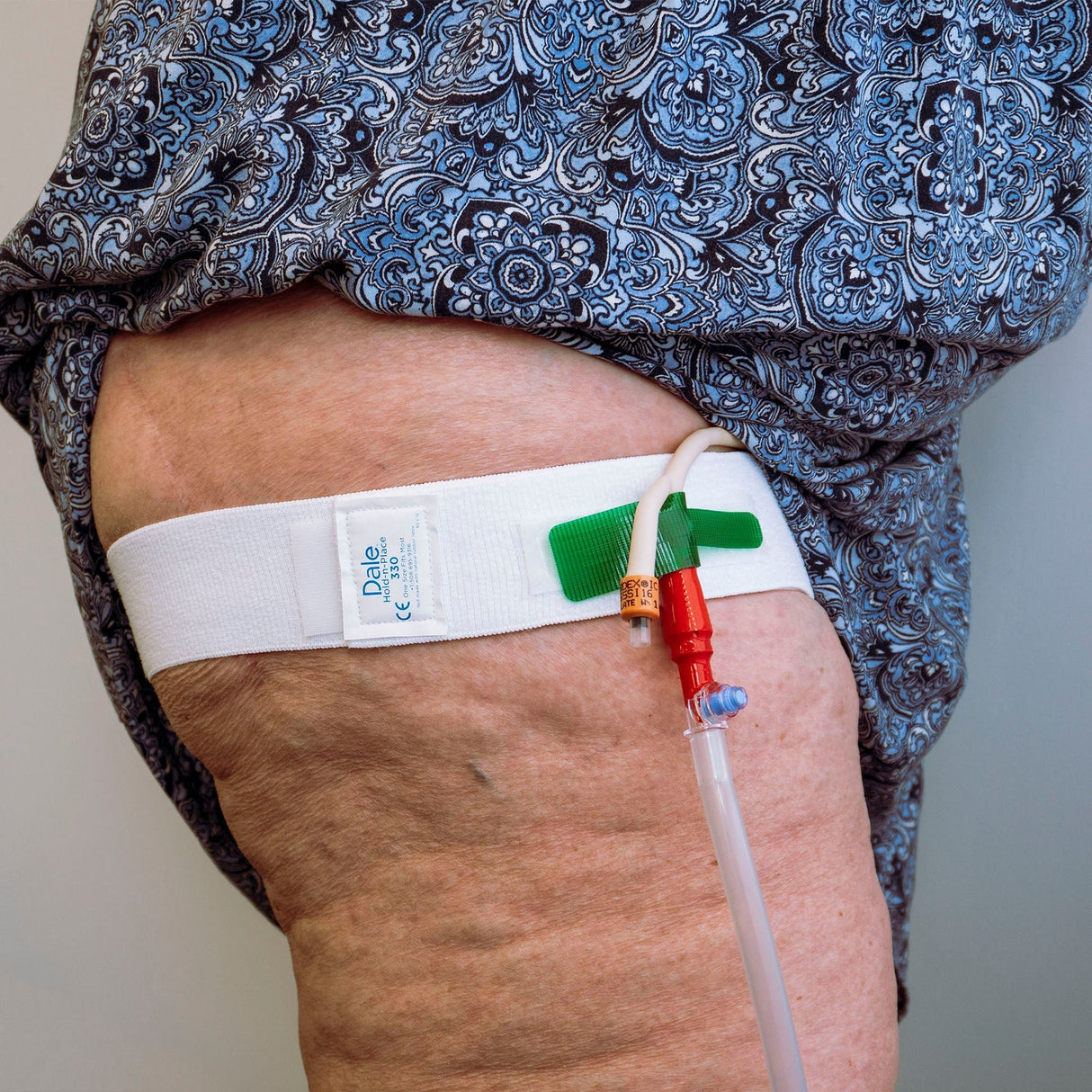 Dale Leg Strap/Waist Band, holds Catheter, fits legs and waists up to 56 Inches - 330-Single - LL Medico