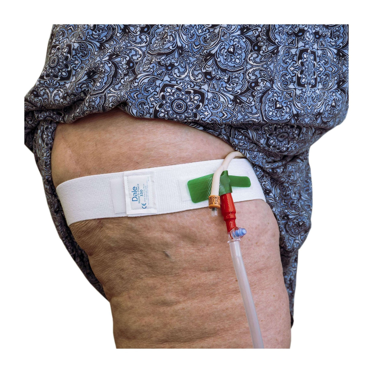Dale Leg Strap/Waist Band, holds Catheter, fits legs and waists up to 56 Inches - 330-Single - LL Medico