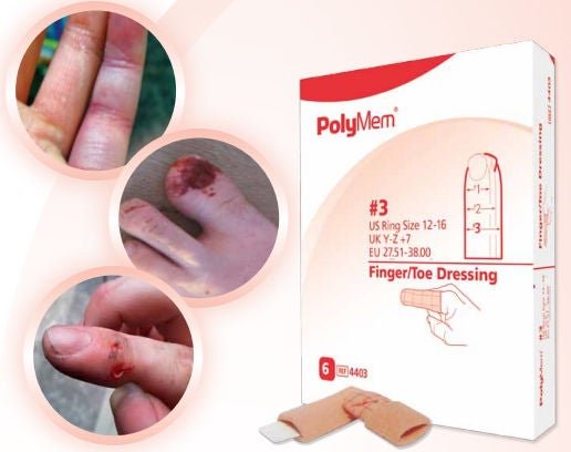 PolyMem Non-Adhesive Finger/Toe Dressing, Sterile, 2 1/5" x 2 3/5" Circumference - 4402-Single - LL Medico