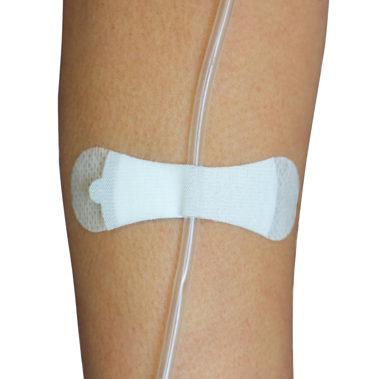 Tidi GRIP-LOK Universal Securement Device - 3200S-Single - LL Medico