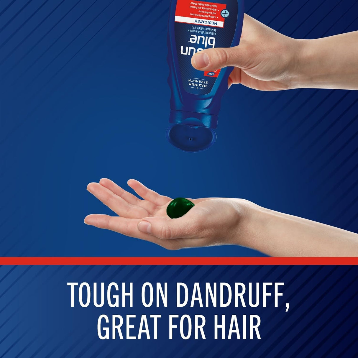 Selsun Blue Medicated Antidandruff Shampoo, Scented, 11 fl oz