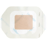 DermaView II Island Transparent Film Dressing with Pad, Frame Style, Rectangle, 3.5 x 4", Adhesive / Film, Sterile - 16340-Single - LL Medico