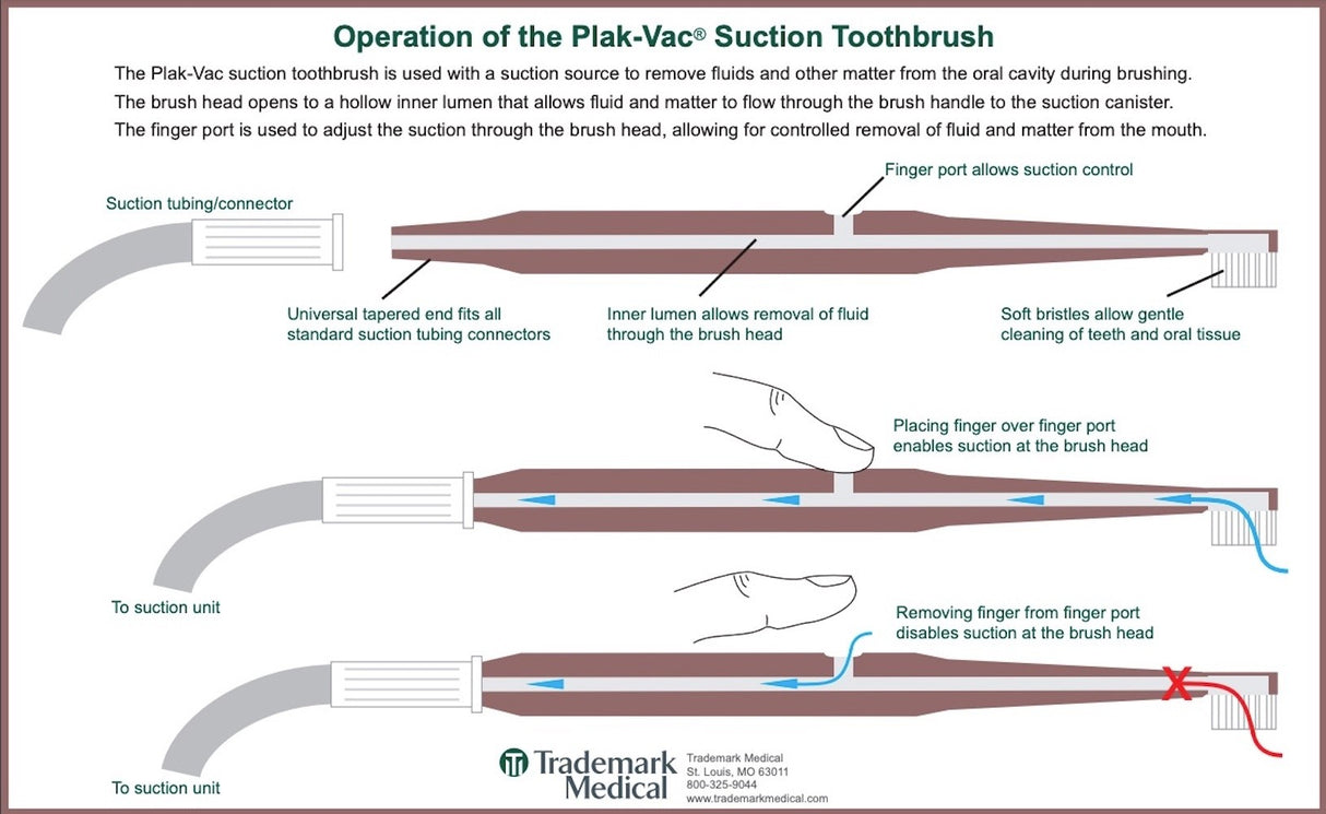 Plak-Vac Suction Toothbrush, Adult Soft