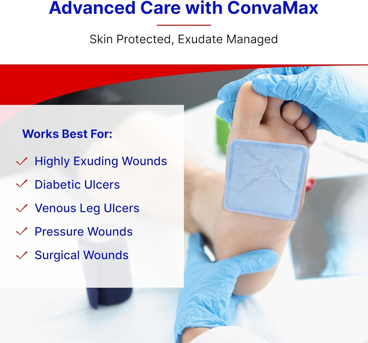 ConvaTec ConvaMax Superabsorber Silicone Adhesive with Border Foam Dressing, 4 x 4 Inch