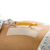 Cath-Secure Tube Holder, Single Hook and Loop Tab, Hypoallergenic, Butterfly Design - 5445-2 - LL Medico