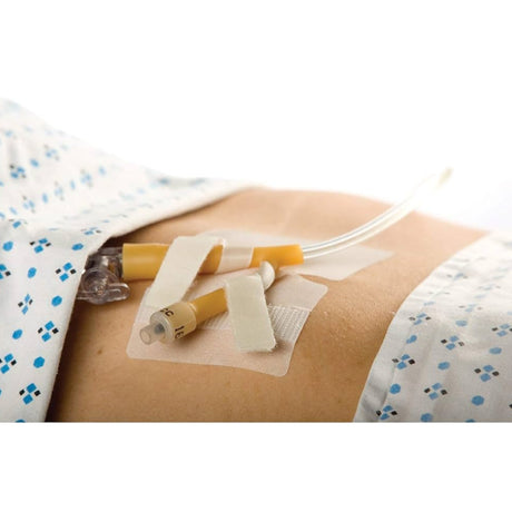 M.C. Cath-Secure Dual Tab Catheter Holder