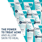 CeraVe Acne Foaming Cream Cleanser, Unscented, 5 fl oz