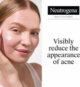 Neutrogena Rapid Clear Stubborn Acne Spot Gel, Maximum Strength, 1 oz