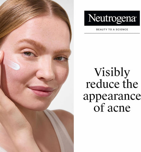 Neutrogena Rapid Clear Stubborn Acne Spot Gel, Maximum Strength, 1 oz