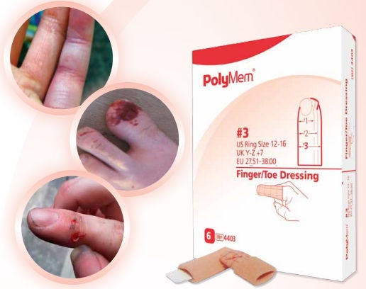 PolyMem Non-Adhesive Finger/Toe Dressing, Sterile, 2 1/5" x 2 3/5" Circumference