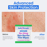 Safe n Simple No-Sting Skin Barrier Film, Unscented