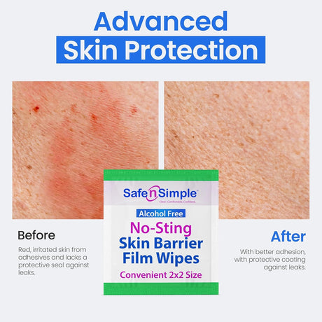 Safe n Simple No-Sting Skin Barrier Film, Unscented