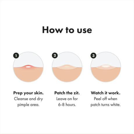 Mighty Patch Acne Treatment