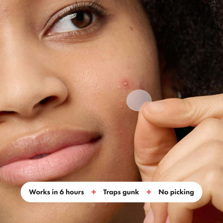 Mighty Patch Acne Treatment
