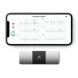 KardiaMobile 6L EKG Monitor
