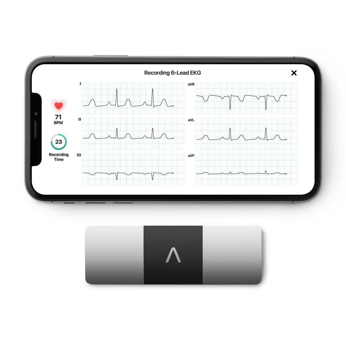 KardiaMobile 6L EKG Monitor