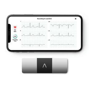 KardiaMobile 6L EKG Monitor