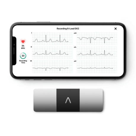KardiaMobile 6L EKG Monitor
