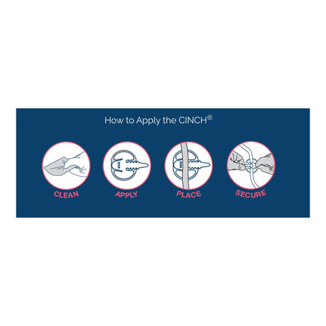 CINCH Tube Securement Device, Large