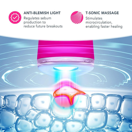 ESPADA 2 Acne Therapy Device, Fuchsia