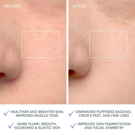 LUNA 4 Facial Cleansing Device for Sensitive Skin
