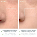 LUNA 4 Facial Cleansing Device for Combination Skin