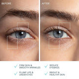BEAR 2 Eyes & Lips Microcurrent Line Smoothing Device, Arctic Blue