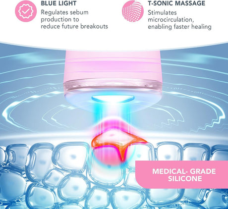 ESPADA 2 Acne Therapy Device, Pearl Pink
