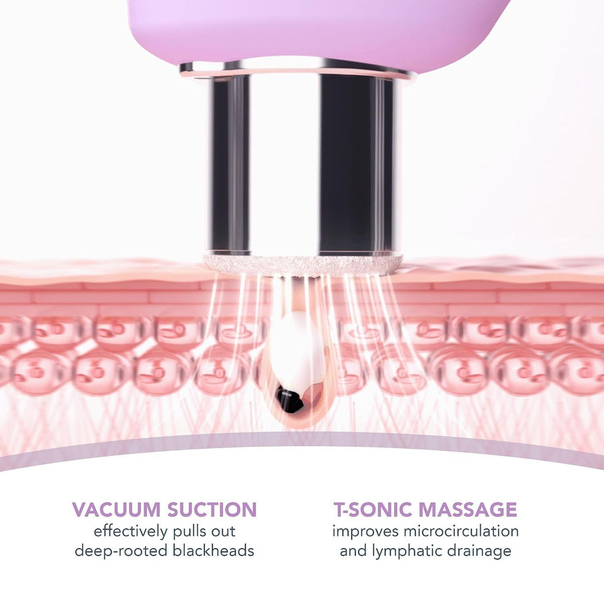 KIWI derma Microdermabrasion Pore Vacuum