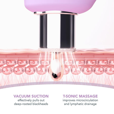 KIWI derma Microdermabrasion Pore Vacuum