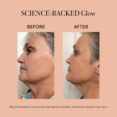 reVive Light Therapy Lux Collection Clinical Device, Anti-Aging and Acne