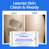 Safe n Simple Adhesive Remover Wipes