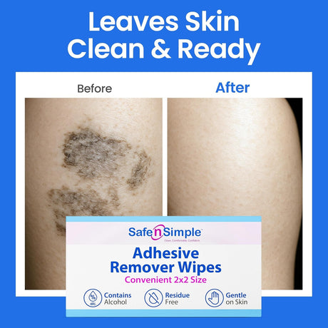 Safe N Simple Adhesive Remover, 2 x 2 Inch Wipe
