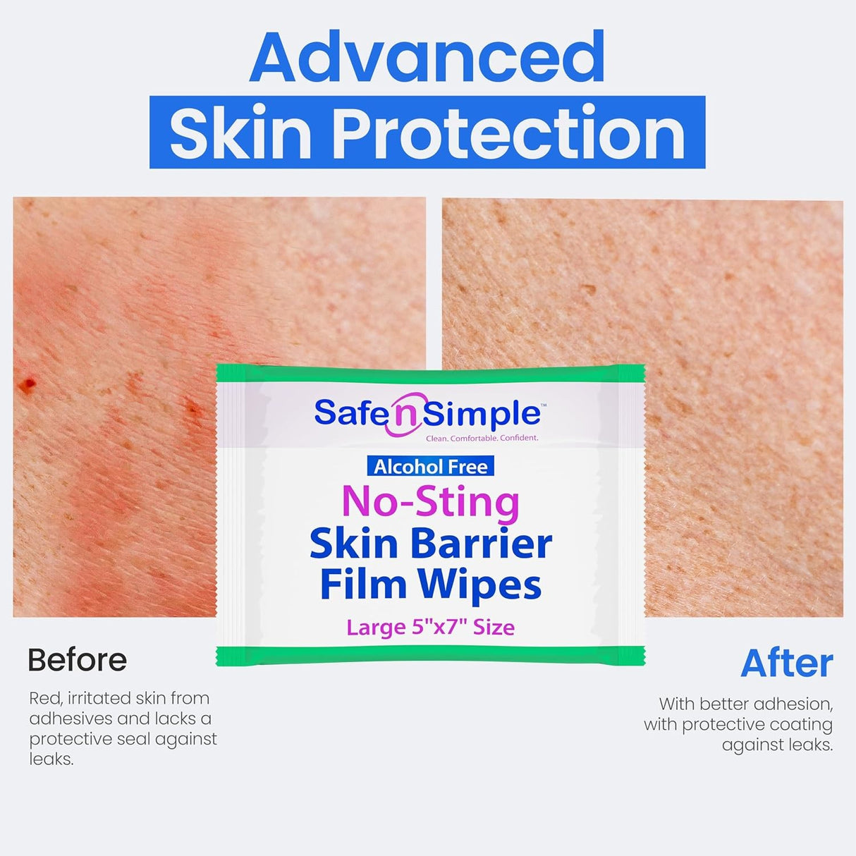 Safe N Simple No-Sting Skin Barrier Wipe, 5 x 7 Inch