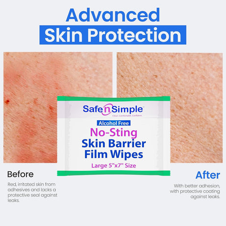 Safe N Simple No-Sting Skin Barrier Wipe, 5 x 7 Inch