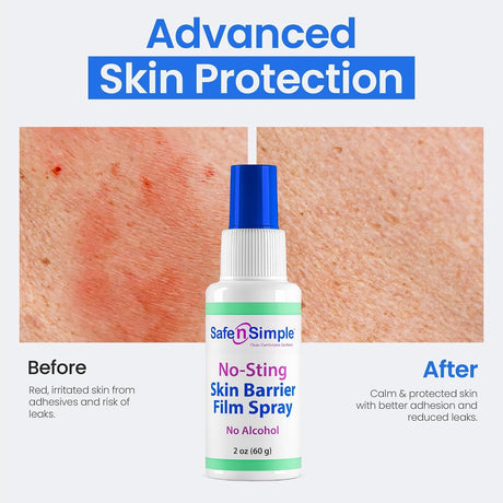 Safe n Simple Skin Barrier Film Spray Bottle, 2 oz