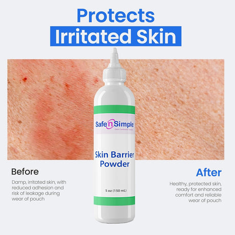 Safe n Simple Stoma Powder