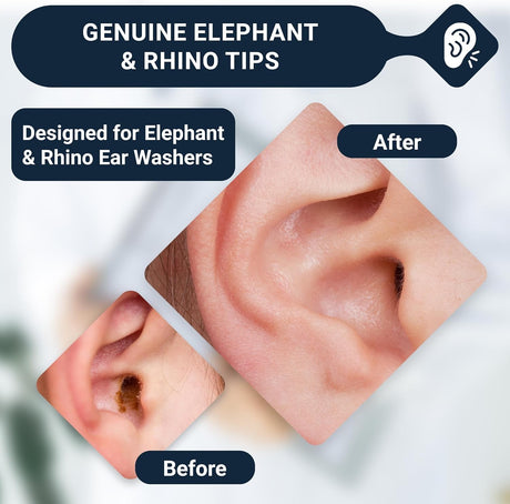 Doctor Easy Rhino/Elephant Ear Washer Single-Use Tips, Pack of 20