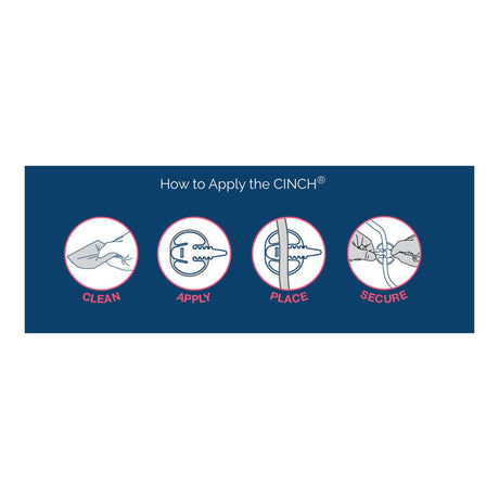 CINCH Tube Securement Device, Medium, 4 to 17 Fr - CINCH417M-10-Single - LL Medico
