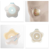Coloplast SenSura Mio Convex Flip Two-Piece Skin Barrier, Star, Pre-Cut, 60 mm Flange - 18524-Box - LL Medico