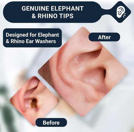Doctor Easy Rhino/Elephant Ear Washer Single-Use Tips, Pack of 20 - TW-Pack - LL Medico